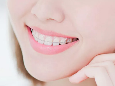 A smiling woman with straight teeth, showcasing a dental product or service.